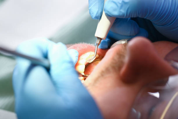 Best Emergency Root Canal Treatment in Hackberry, TX